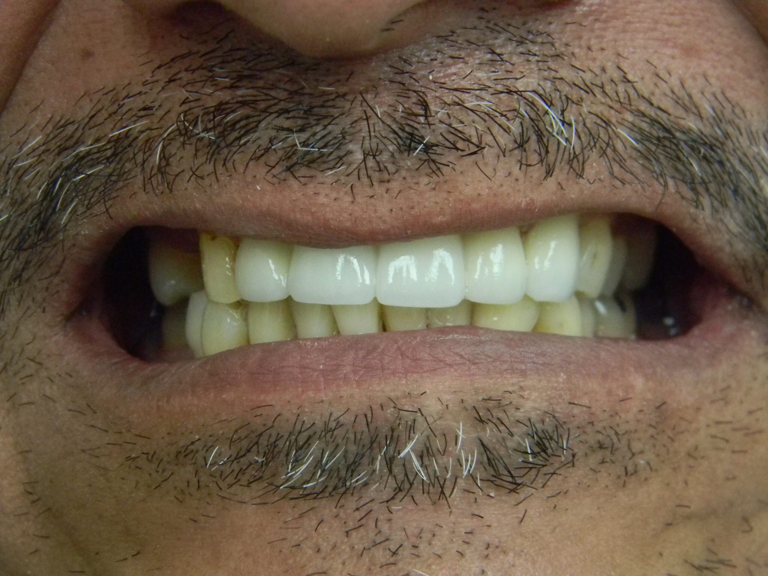 before and after image