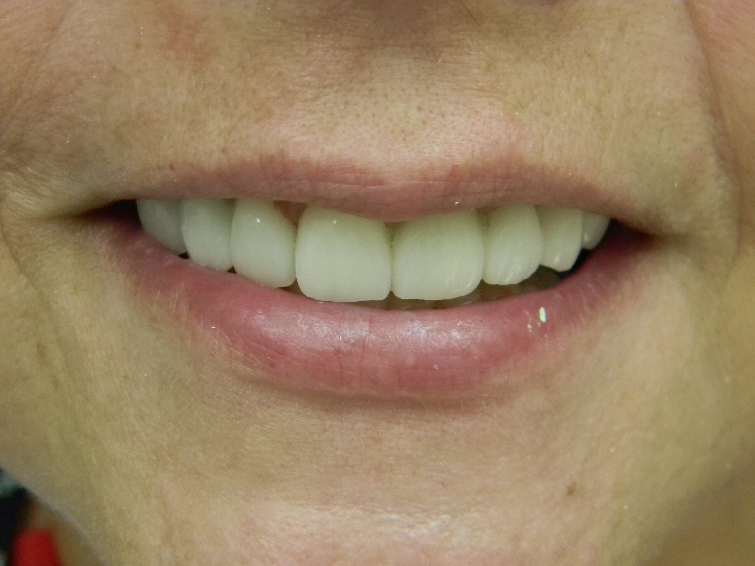 before and after image