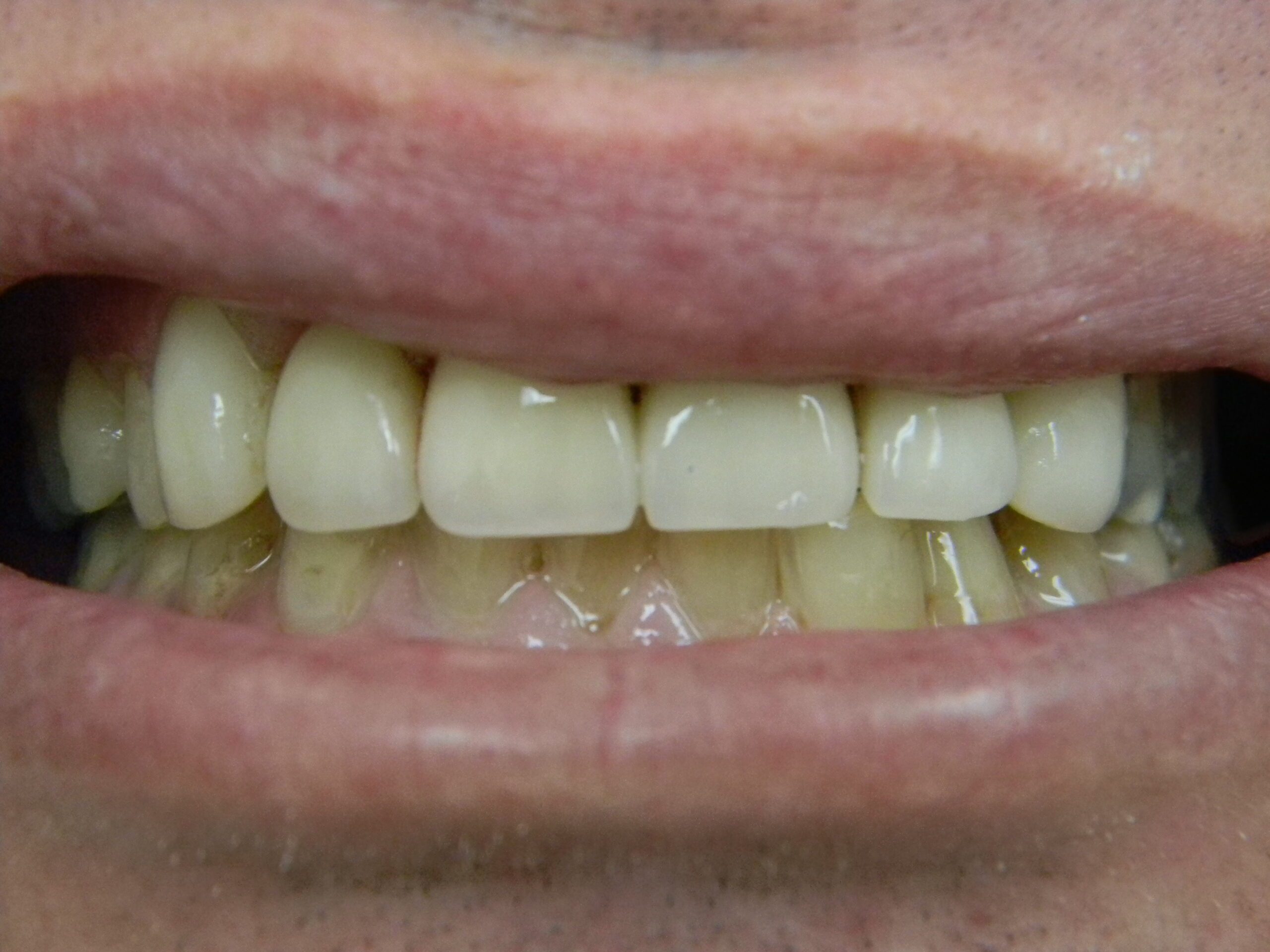 before and after image