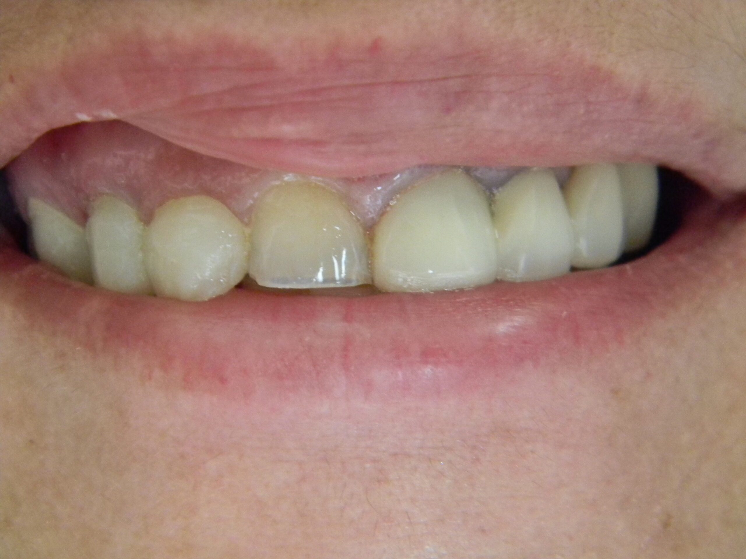 before and after image