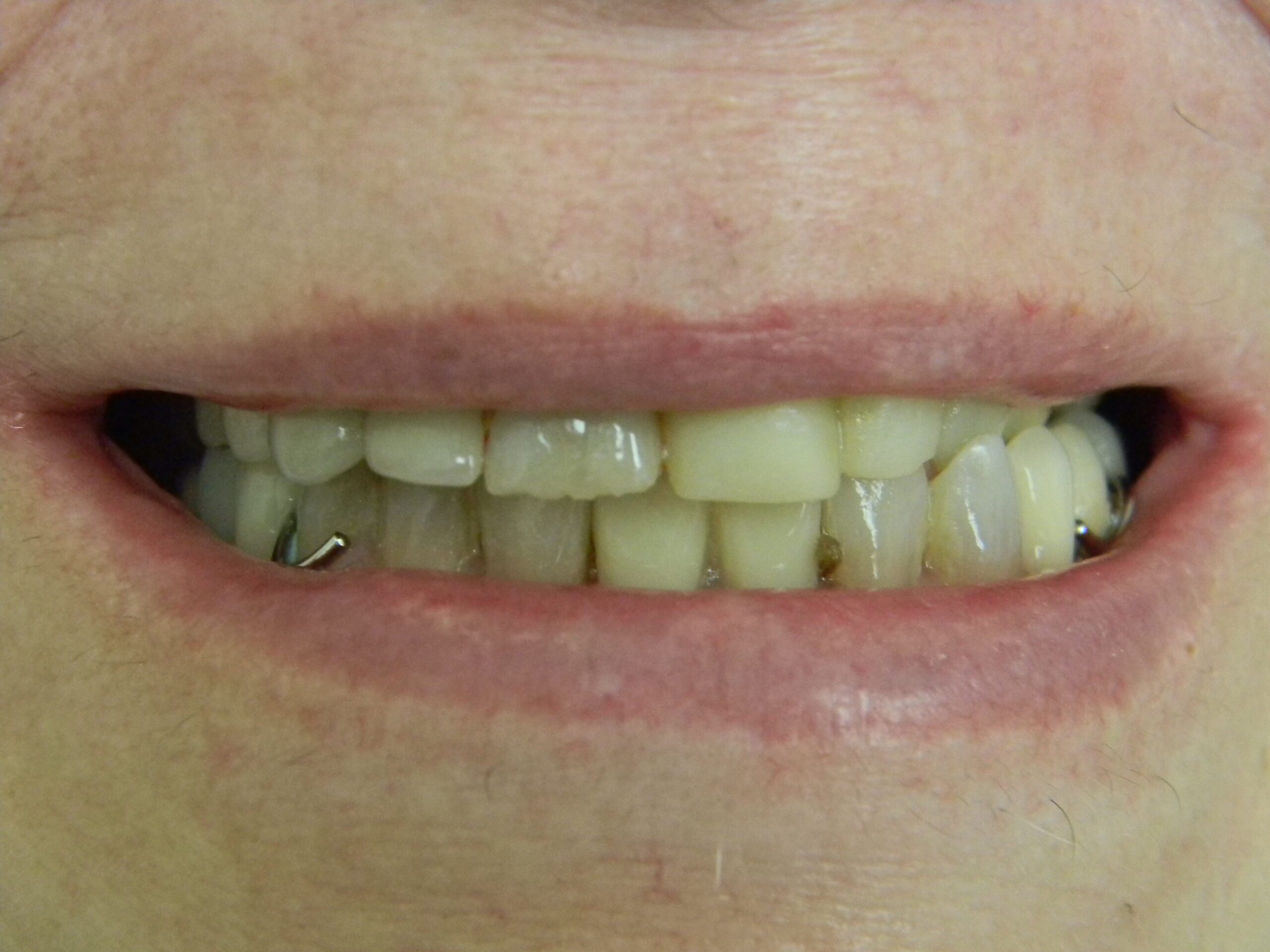 before and after image