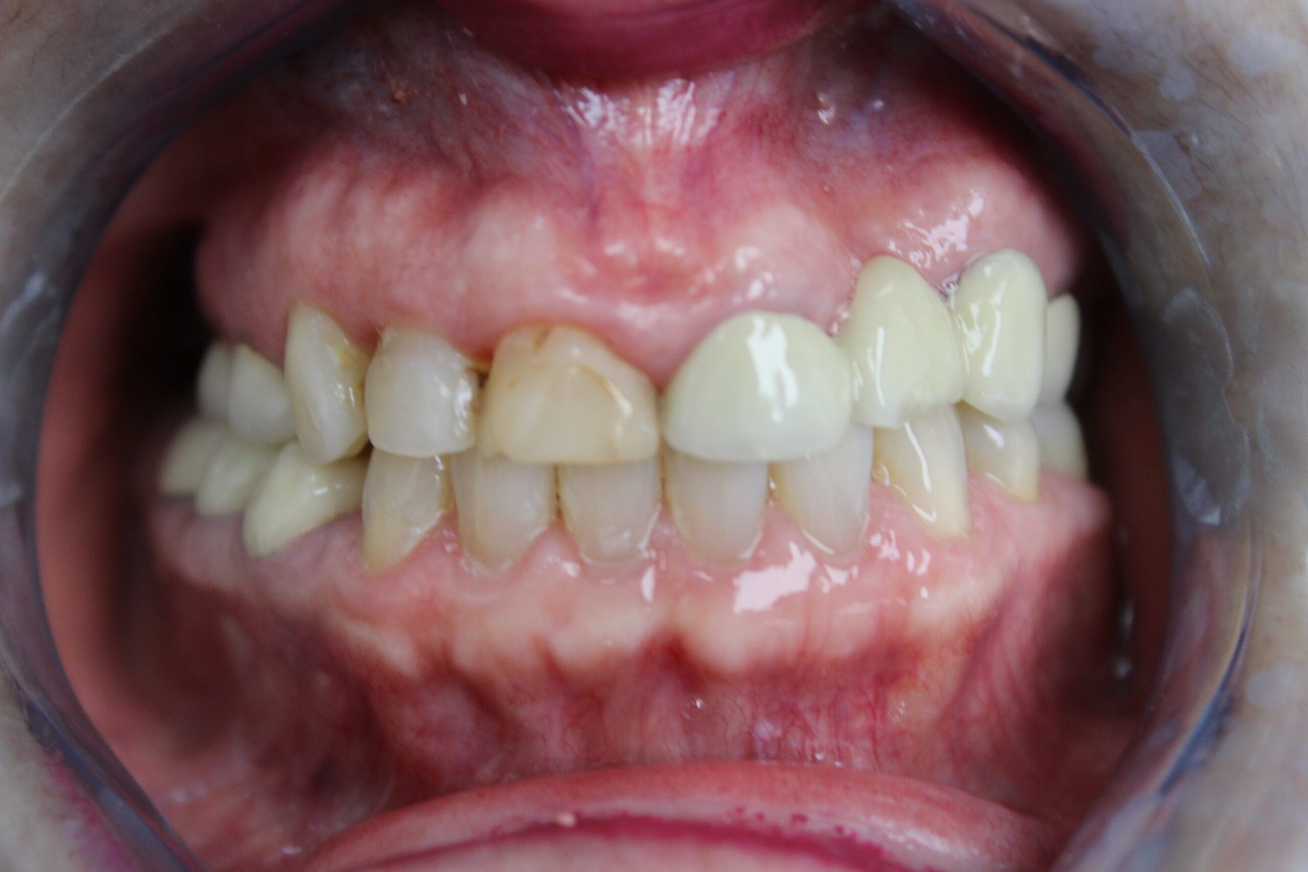 before and after image