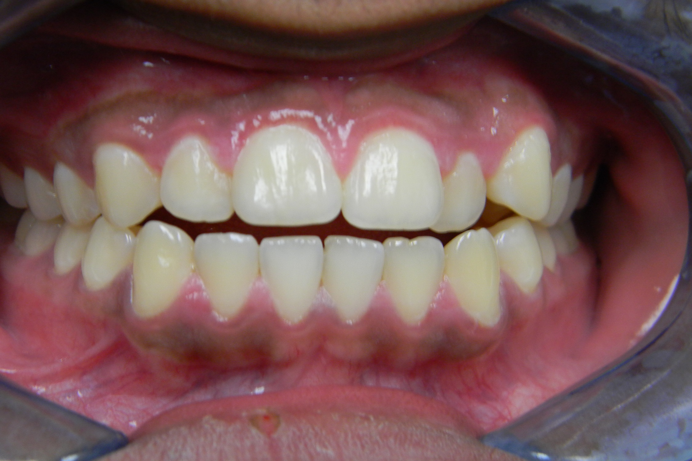 before and after image